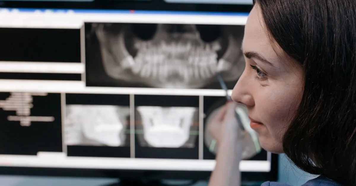 Implantes o carillas hechos en Turquía: qué pasa si algo sale mal cuando ya has vuelto a España