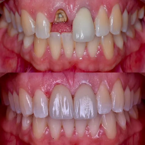 Ridere Estudio Dental - Dentista Alicante - Clínica Dental Alicante - Alicante