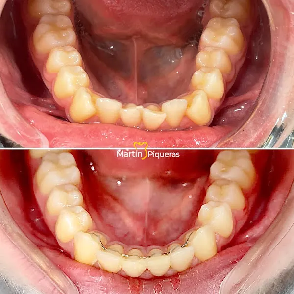 CLINICA DENTAL MARTÍN & PIQUERAS - MYPDENTAL en Adra