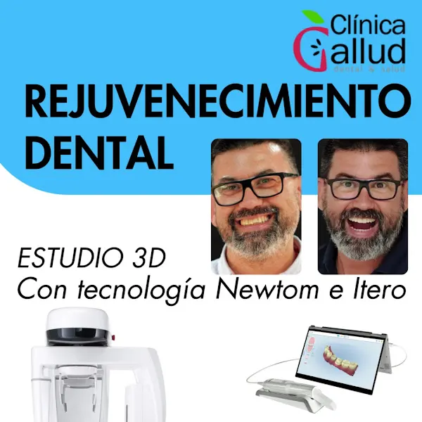 Clinica Dental Gallud - Clínica dental en Orihuela - foto 2