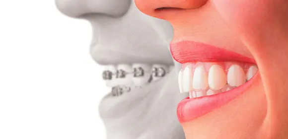 Clinica Dental Duperier - Clínica dental en Ávila