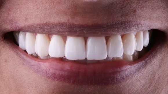 Clinica Dental Aarvo Suisse Gran Vía