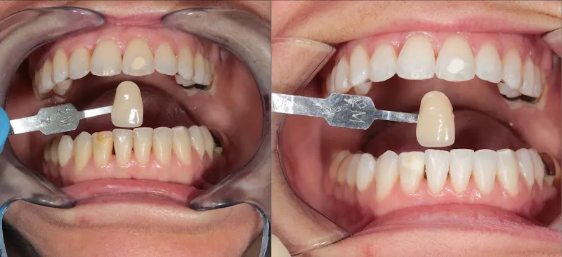 Clinica Dental Dra Maria Jaume - Sant Cugat del Vallès