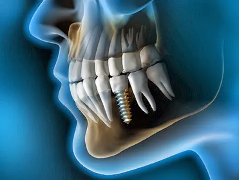 Clinica Dental Abedent Prat (Dra. Mónica Gelada) - Clínica dental en El Prat de Llobregat - foto 2