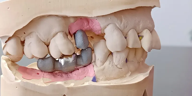 Clínica Arc Dental en Manresa | Dentista en Manresa en Manresa