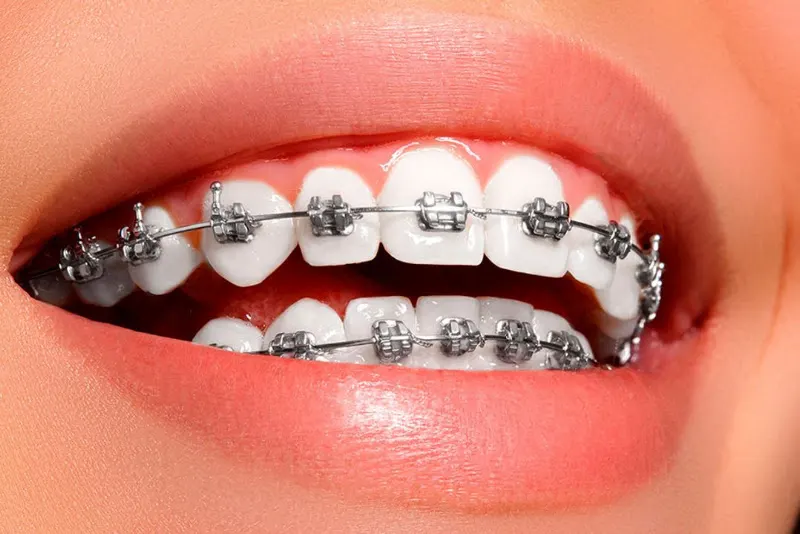 Clínica Dental Vitaldent