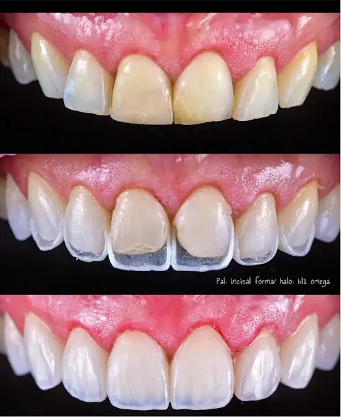 Clinica Propdental Barcelona- Eixample - Clínica dental en Barcelona - foto 3