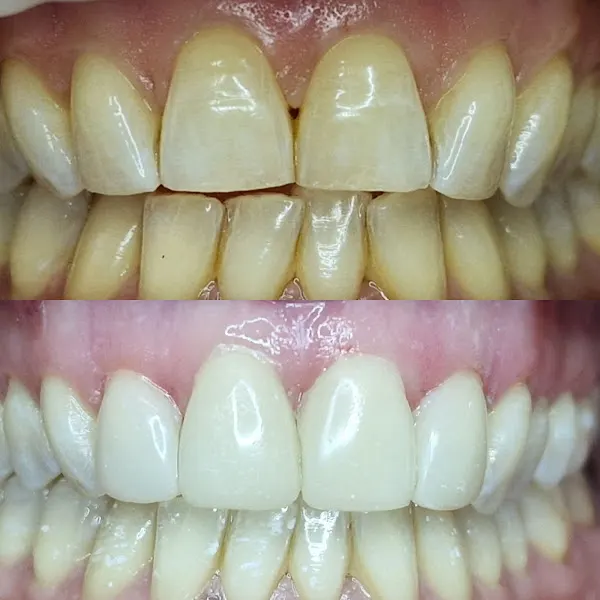 Top Dental Granollers - Granollers