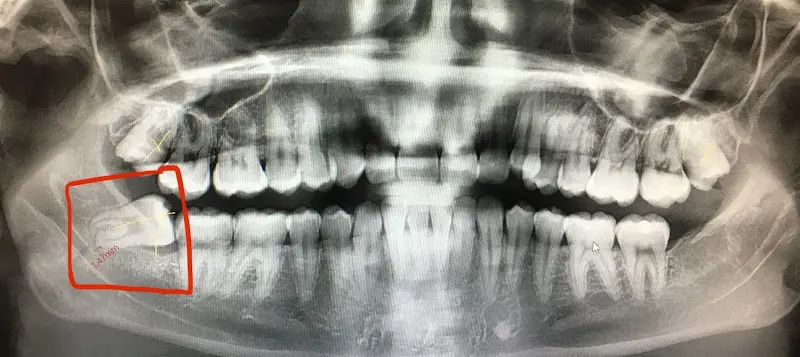 Centro Dental Integral - Dentista en San Roque - foto 2
