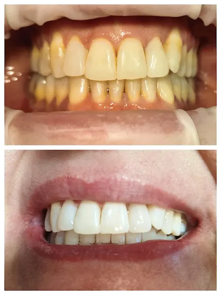 Clínica Dental Portichuelo