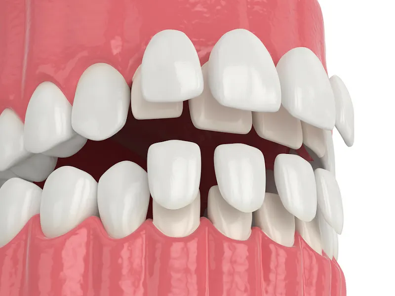 Clínica Dental Miengo - Pielagos