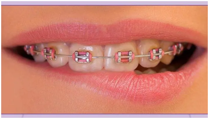 Clínica Dental Angela Pla - Vinaròs