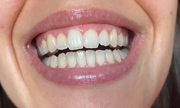 Clinica Dental Bravo
