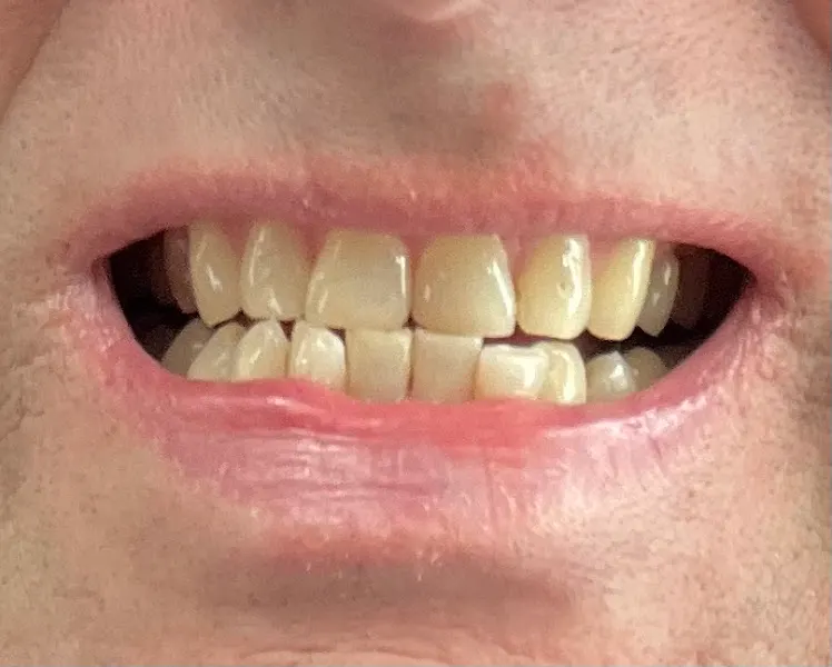 Clínica Dental Implantdent Palafrugell - Palafrugell