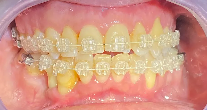 Clínica Dental Ruiz Cuadros