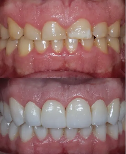 Clínica ZeroDental - Guadalajara