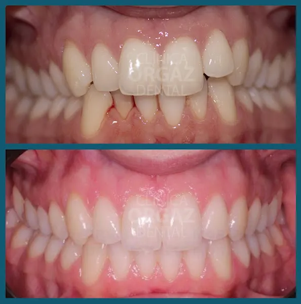 Clínica Dental Orgaz Usera - Dentistas - Implantes dentales - Clínica dental en Madrid