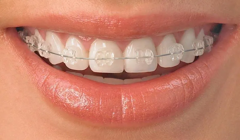 Clínica Dental Eva Marcos - Las Rozas