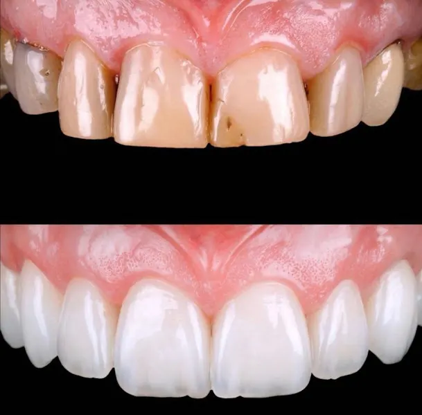 Nature Dental