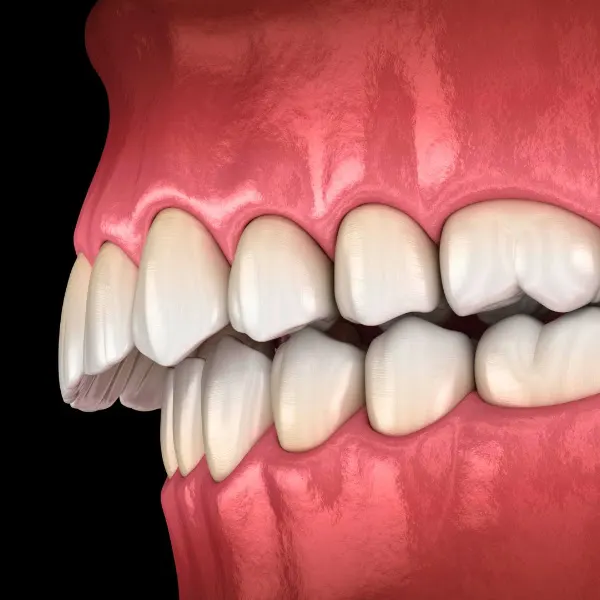 Clínica Dental Doctores Gómez - Caravaca de la Cruz