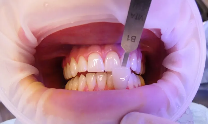 Clínica Dental Vitaldent - Clínica dental en Yecla - foto 2