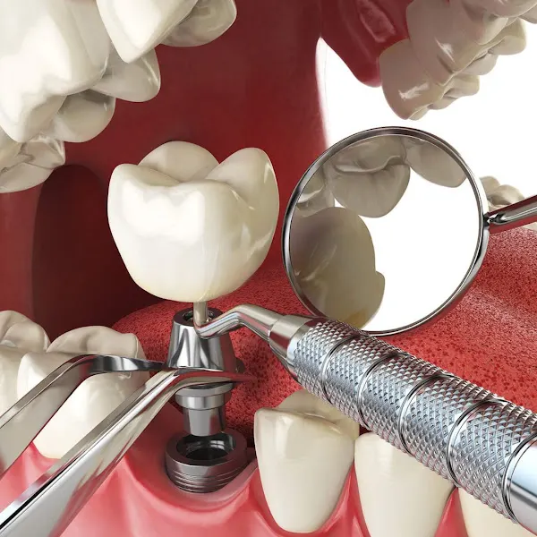 Dra. Manzanares Clínica Dental - Dentista en Murcia - foto 2