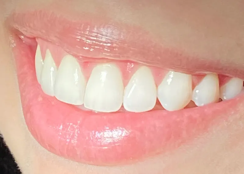 Clínica Dental Fabiola Santaella - Dentista en Pamplona
