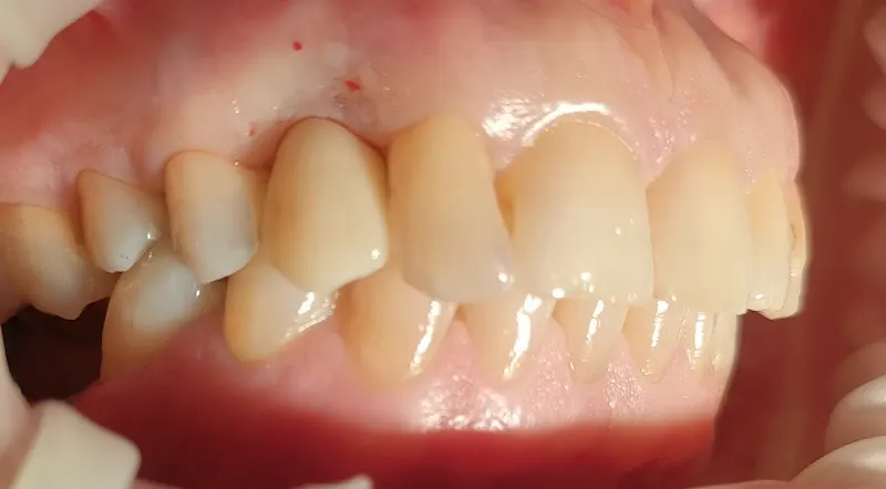 Clínica Dental Ernesto del Valle ( SANTA AURELIA)