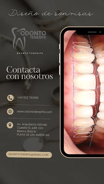 OdontoTenerife - Clínica dental en Arona - foto 2