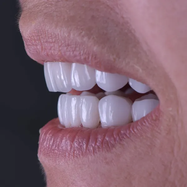 Eurodental - Clínica dental en Adeje - foto 3