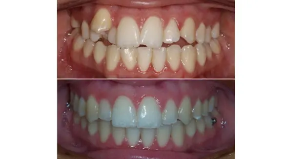 Clinica Dental Pere Alcantara - Valencia