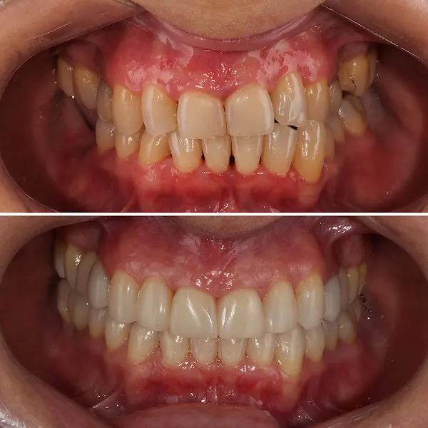 Clínica Dental Peydro Herrero - Ortodoncista en Valencia - foto 3