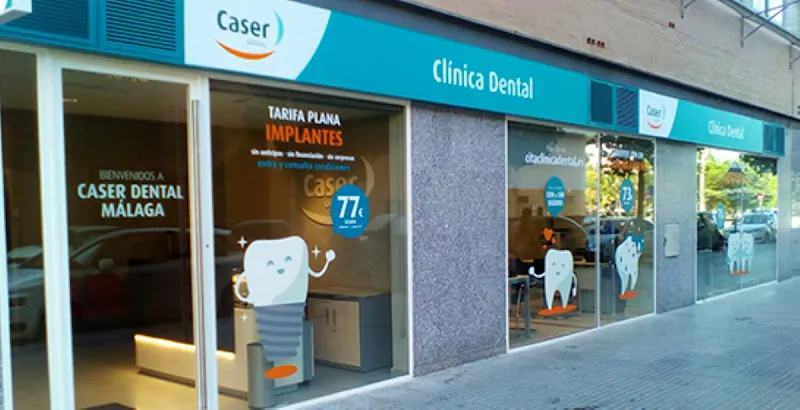 Clinica Dental Caser Málaga