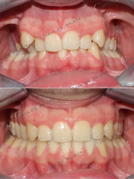 Clínica Dental Dávalos & Balboa - Dentista en Murcia - foto 3