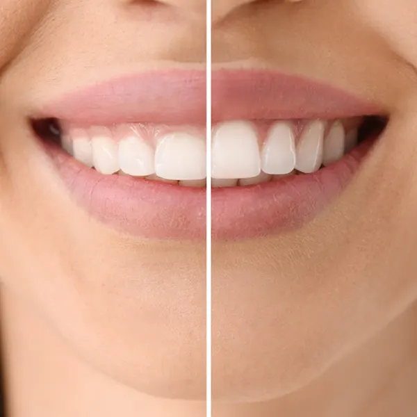 Pérez Llanes Clínica Dental