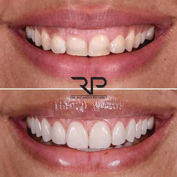 Clínica dental Dr Ricardo Pizarro