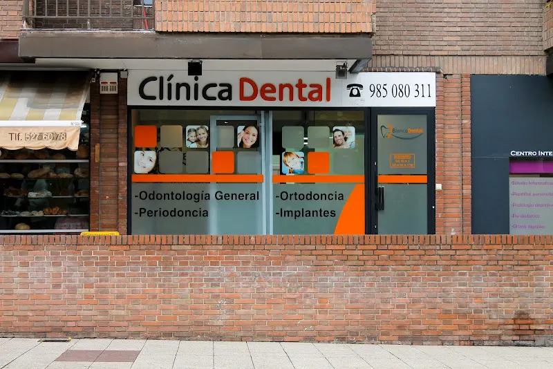 Clínica Blanco Dental - Oviedo