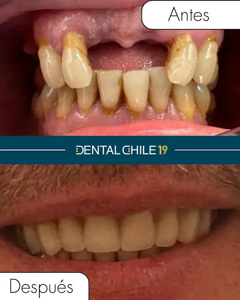 CLÍNICA DENTAL CHILE - Clínica dental en Logroño - foto 2