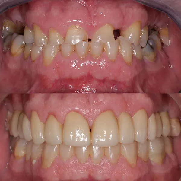 Clínica Gallardo Dental