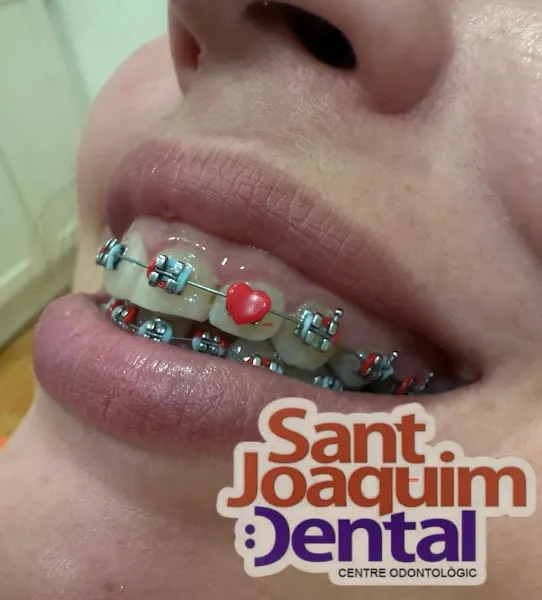 Clínica Dental Sant Joaquím - Clínica dental en Santa Coloma de Gramenet - foto 2