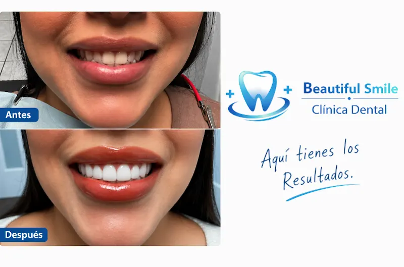 🦷 Clínica Dental Beautiful Smile