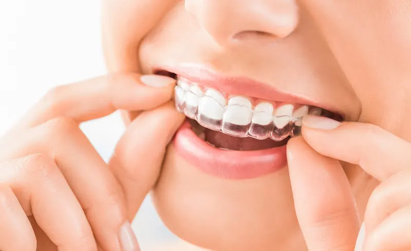 Clínica Dental ARAVACA y POZUELO | Doctores Chabani - Clínica dental en Madrid - foto 2