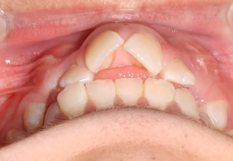 Porto Europa Dental S L - Dentista en Coslada - foto 2