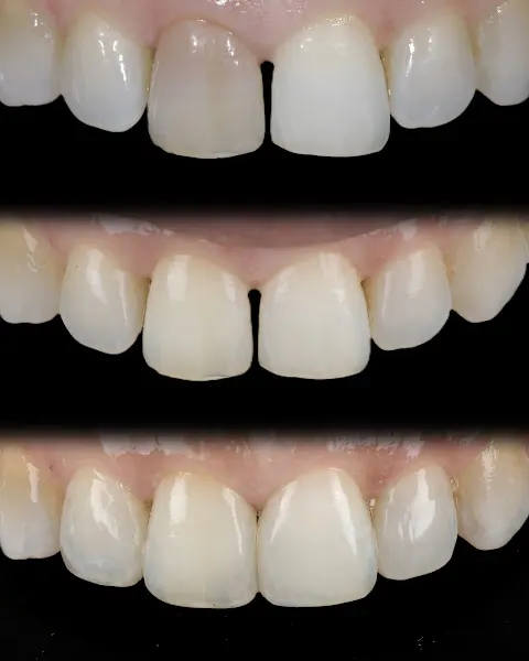 Clínica Dental Viéitez Núñez - Clínica dental en Fuengirola - foto 3