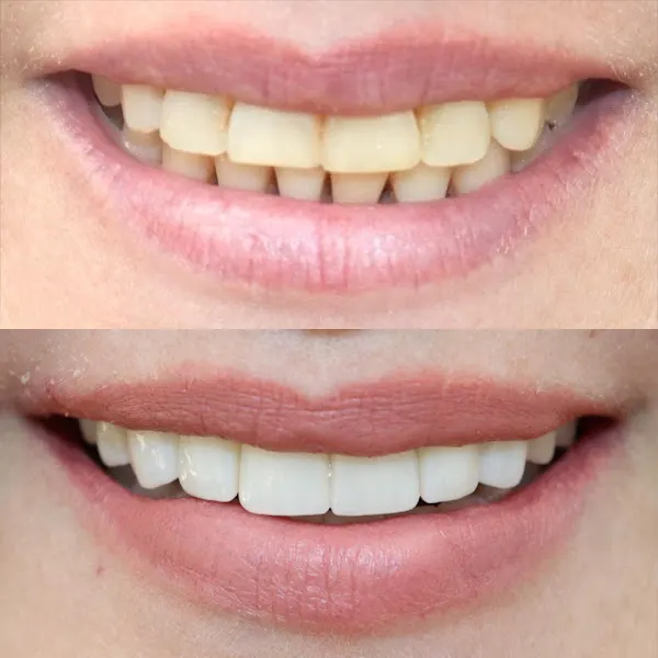 Medical Dent