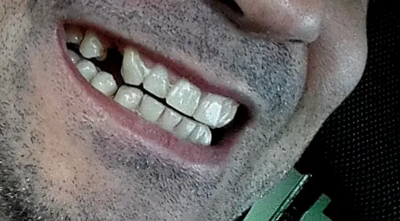 Clinica Dental Sueca en Agüimes