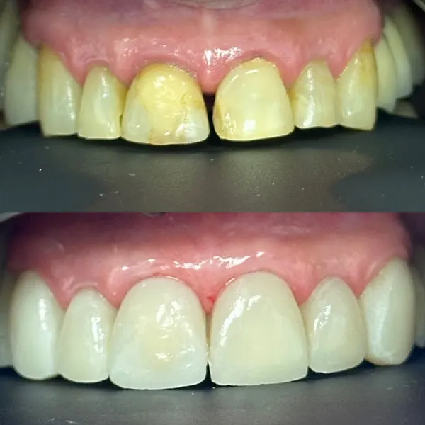 Clínica Dental Dora Torres