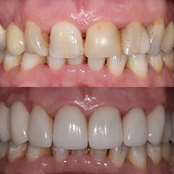 CLINICASMELT - Dentista en Granollers - foto 3