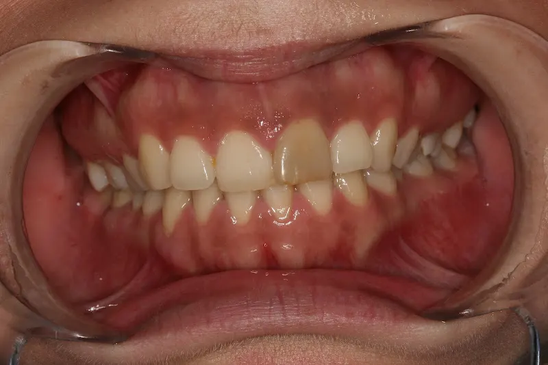 Puche Lázaro - Dentista en Aranjuez - foto 2