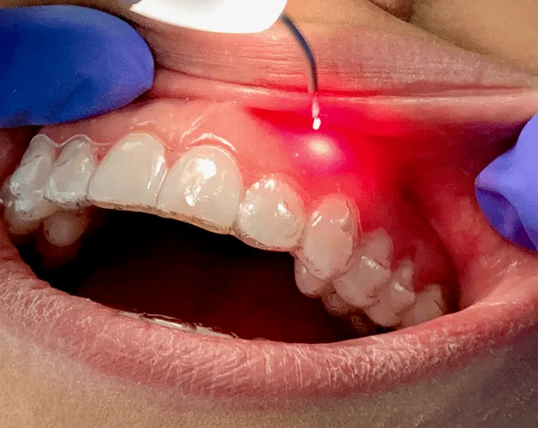 CLÍNICA DENTAL PÉREZ ANTONA - Dr. Francisco Javier Pérez Antona